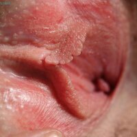 Hairy vulva with beautiful pink petals