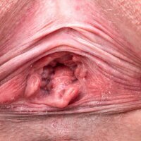 Wide open stretched adult MILF cunt of Caroline Diaz